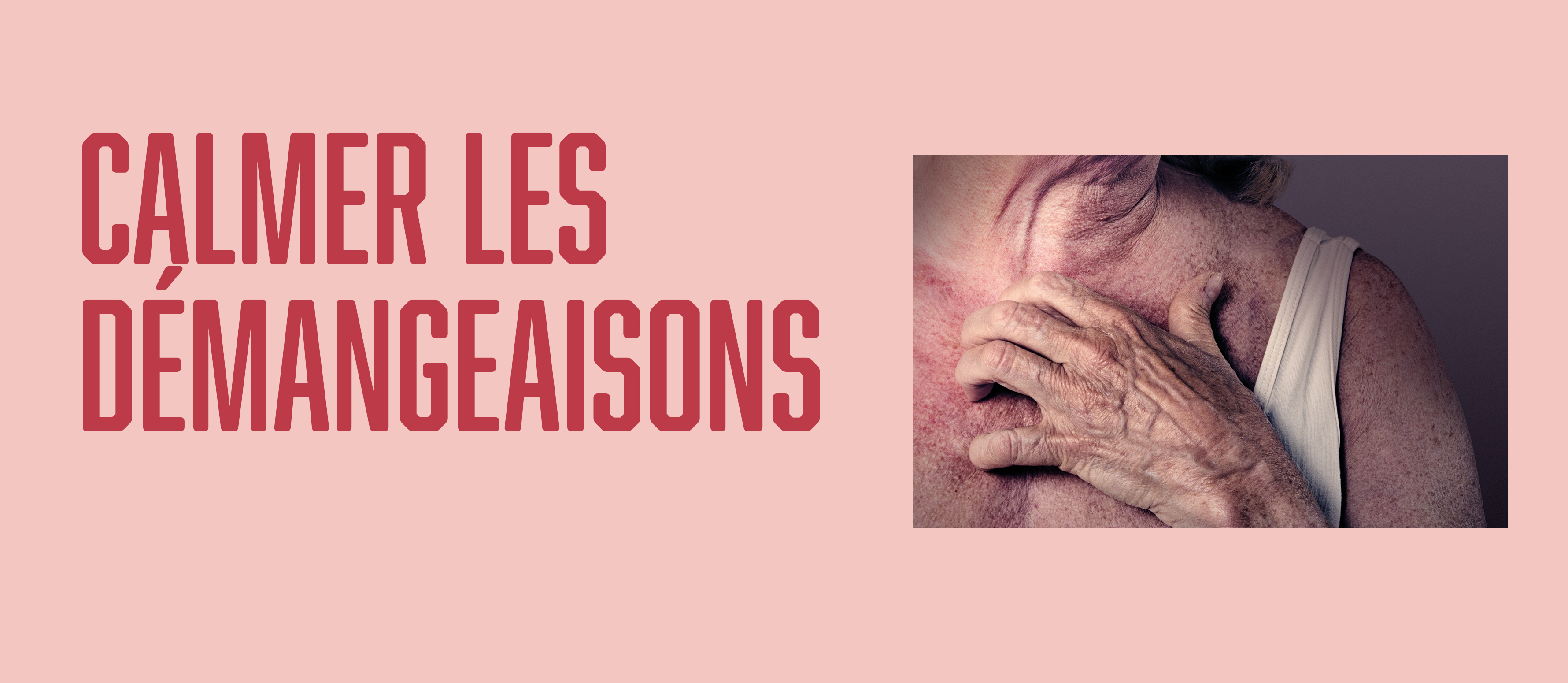 Calmer Les Démangeaison 